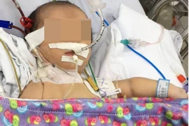 Nhiễm độc ammoniac vì rối loạn chuyển hóa bẩm sinh 