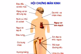 Bấm huyệt tay giảm ngay triệu chứng tiền mãn kinh