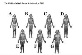 Trẻ càng thừa cân càng tăng tỷ lệ thiếu vitamin D
