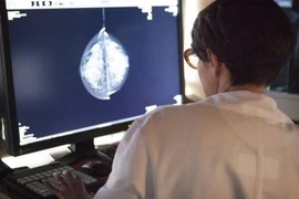 Công nghệ máy học chẩn đoán ung thư vú