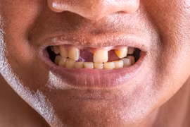 Các nhà khoa học tìm ra cách có thể giúp con người mọc lại răng