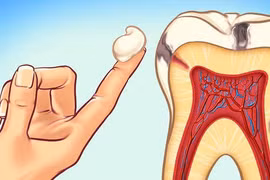 Nha sĩ tiết lộ 10 cách đơn giản để ngăn ngừa sâu răng