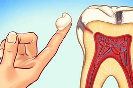 Nha sĩ tiết lộ 10 cách đơn giản để ngăn ngừa sâu răng