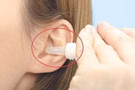 Có nên nhỏ nước muối sinh lý vào tai?