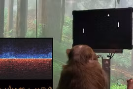 Dự án thử nghiệm kết nối não với internet bị kiện 