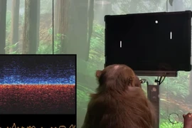 Dự án thử nghiệm kết nối não với internet bị kiện 