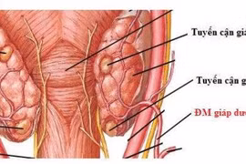 Cắt bỏ u tuyến cận giáp là phương pháp hiệu quả
