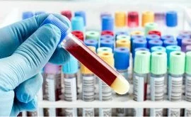 Sử dụng trí tuệ nhân tạo dự đoán khả năng sống của bệnh nhân Covid-19