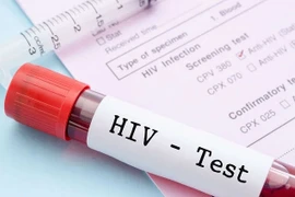 Phần lớn kết quả xét nghiệm HIV sai là do con người