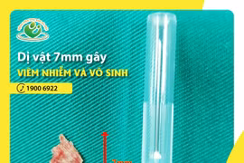 Dị vật buồng tử cung gây vô sinh