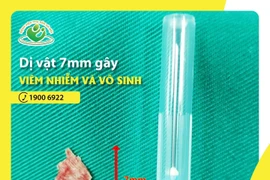 Dị vật buồng tử cung gây vô sinh