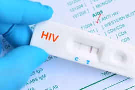 Bất ngờ phát hiện mắc HIV