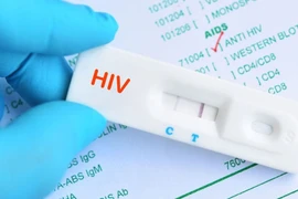 Bất ngờ phát hiện mắc HIV