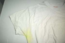 Đồng phục bí, nóng gây mùi hôi