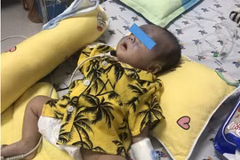 Bé 2 tháng tuổi ho, khó thở vì bị mạch máu quấn quanh khí quản