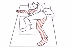 Giải pháp cải thiện liệt nửa người bên phải sau tai biến mạch máu não nhờ sản phẩm thiên nhiên