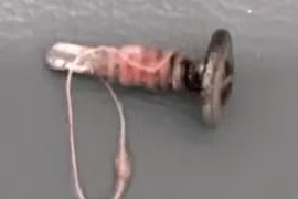 Trẻ mầm non tử vong thương tâm do hóc đinh vít