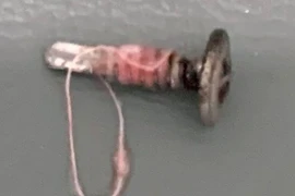 Trẻ mầm non tử vong thương tâm do hóc đinh vít