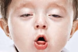 Con viêm mũi họng tái đi tái lại vì bố hút thuốc