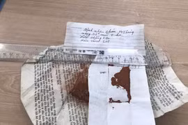 Suy gan cấp do bôi thuốc cam trị nhiệt miệng