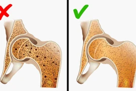Con gái có thể mắc bệnh di truyền nào từ mẹ?