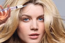 Nguy hiểm khi tiêm botox làm đẹp tóc