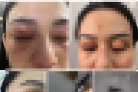 Người bị đánh ở shop Trang Nemo lên tiếng: Giang hồ cả chục đánh 1 người phụ nữ mới sinh