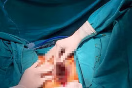 Can thiệp chỉnh sửa bộ phận sinh dục