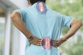 Cắt bảng sống trong vôi hóa cột sống