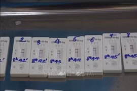 Khuyến cáo người tiêu dùng khi mua kit test nhanh COVID-19