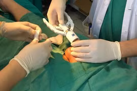 Ung thư vì chủ quan với chít hẹp bao quy đầu