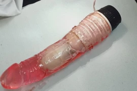 "Tự sướng", sextoy mắc kẹt trong trực tràng