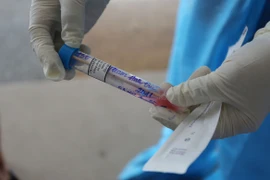 Đồng Nai phát hiện ca nghi Covid-19