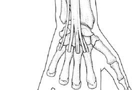  Kích thích huyệt tay điều trị cổ cứng đau