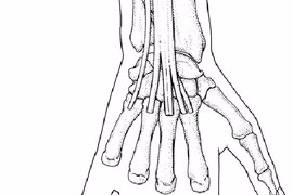  Kích thích huyệt tay điều trị cổ cứng đau