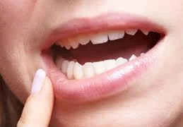 Nổi cục thịt dưới nướu