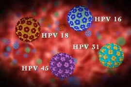 Nhiễm HPV và ung thư