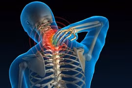 Điều trị thoái hóa đốt sống cổ lâu khỏi