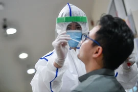 Người dân có được bảo hiểm y tế thanh toán phí xét nghiệm Covid-19?