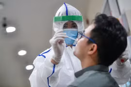 Người dân có được bảo hiểm y tế thanh toán phí xét nghiệm Covid-19?