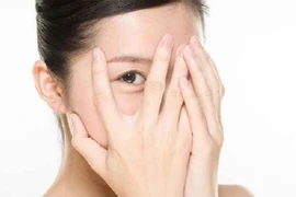 Thâm mắt do hốc mắt sâu