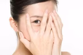 Thâm mắt do hốc mắt sâu