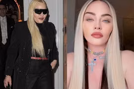 Lạm dụng thẩm mỹ, Madonna gây sốc khi lộ nhan sắc thực biến dạng