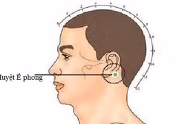 Chữa ho do ngoại cảm