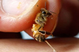 Bé trai 5 tuổi suy gan thận nghiêm trọng do bị ong đốt