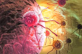 Nghiên cứu mới điều trị ung thư không sử dụng hóa trị và xạ trị