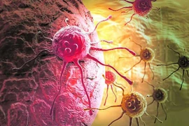 Nghiên cứu mới điều trị ung thư không sử dụng hóa trị và xạ trị