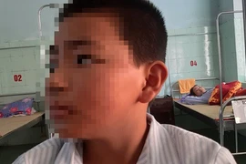 Học sinh bị phạt 231 cái tát, hiệu trưởng xin báo chí đừng lên tiếng