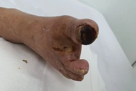 Sai một li đi cả chi!