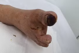 Sai một li đi cả chi!